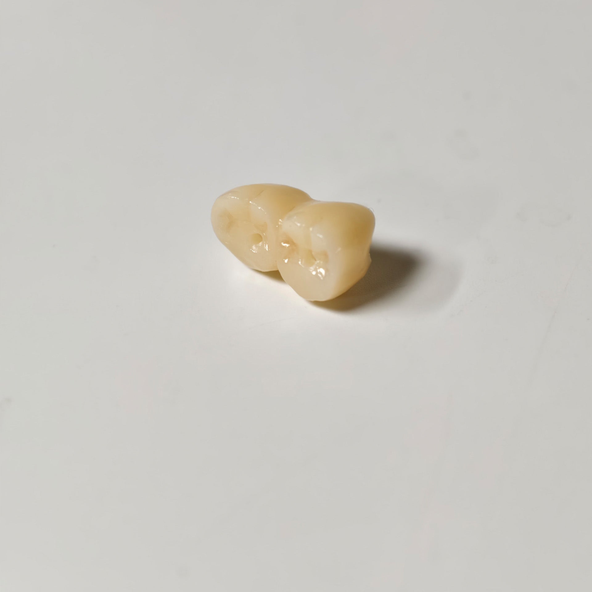 Zirconia Implant Bridge Screwmentable Dental Crown