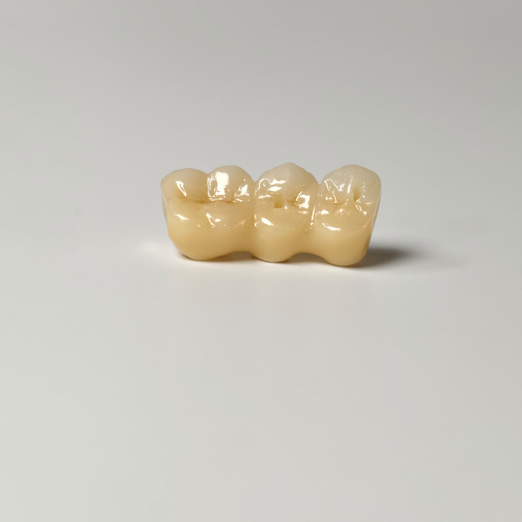 Zirconia Implant Bridge Screwmentable Dental Crown