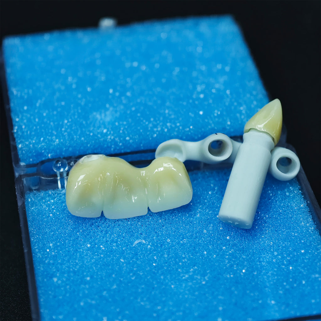 Zirconia Implant Bridge Screwmentable Dental Crown
