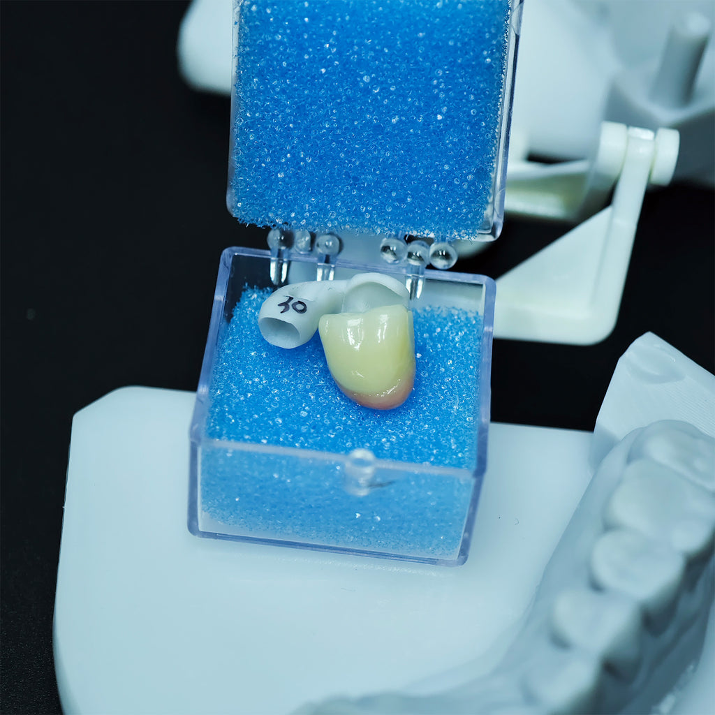 Zirconia Implant Crown Screwmentable Dental Crown