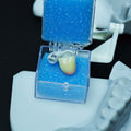 Zirconia Implant Crown Screwmentable Dental Crown