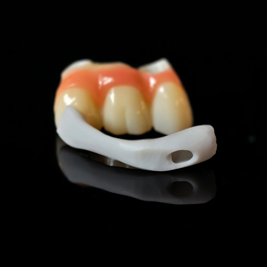 Zirconia Implant Crown Screwmentable Dental Crown