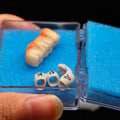 Zirconia Implant Crown Screwmentable Dental Crown