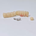 Zirconia Implant Crown And Bridges Screwmentable Dental Crown