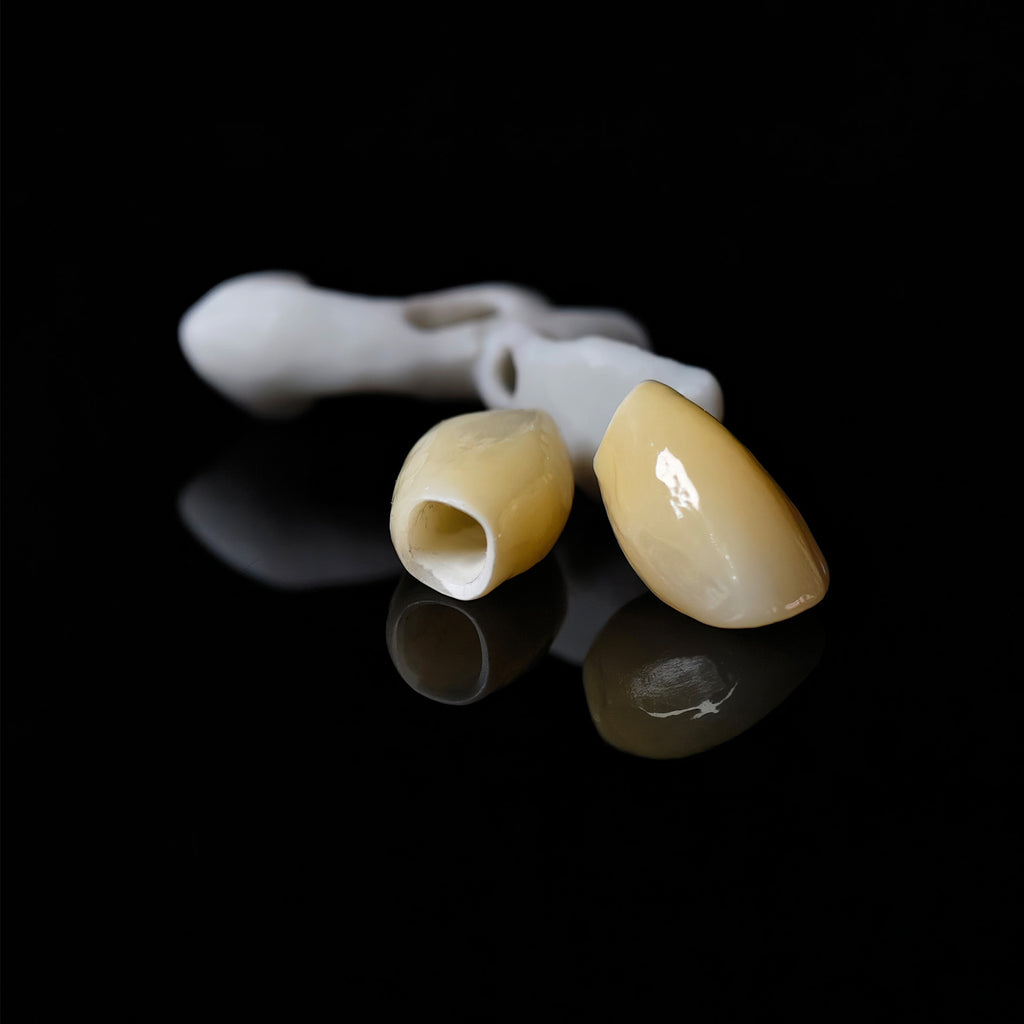 Zirconia Implant Crowns Screwmentable Dental Crown With Gold Plating