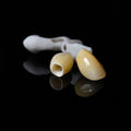 Zirconia Implant Crowns Screwmentable Dental Crown With Gold Plating