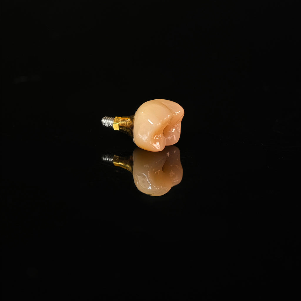 Zirconia Implant Crown With Gold Plating