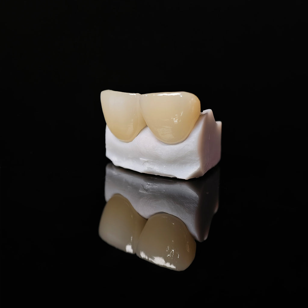 Zirconia Veneer. High Transparency/Translucent, Natural Shade
