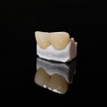 Zirconia Veneer. High Transparency/Translucent, Natural Shade