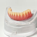 Acrylic Denture With Ti-Bar And Screw Retained