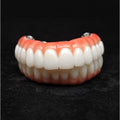 All On 4 Zirconia Bridge With Ti-Base Screw Retained Trying For Full Arch Restoration