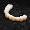 All On 4 Zirconia Bridge With Ti-Base Screw Retained Trying For Full Arch Restoration