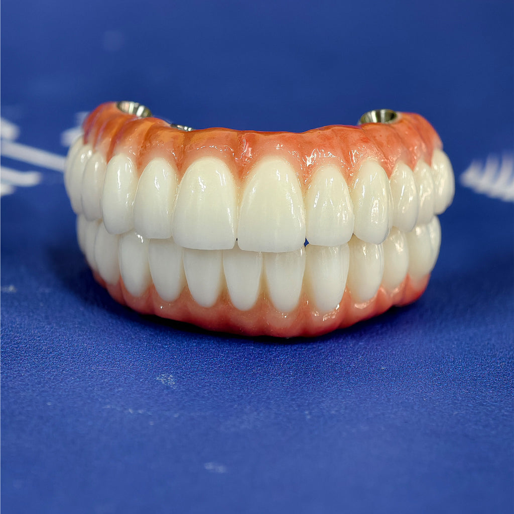 All On 4 Zirconia Bridge With Ti-Base Screw Retained Trying For Full Arch Restoration