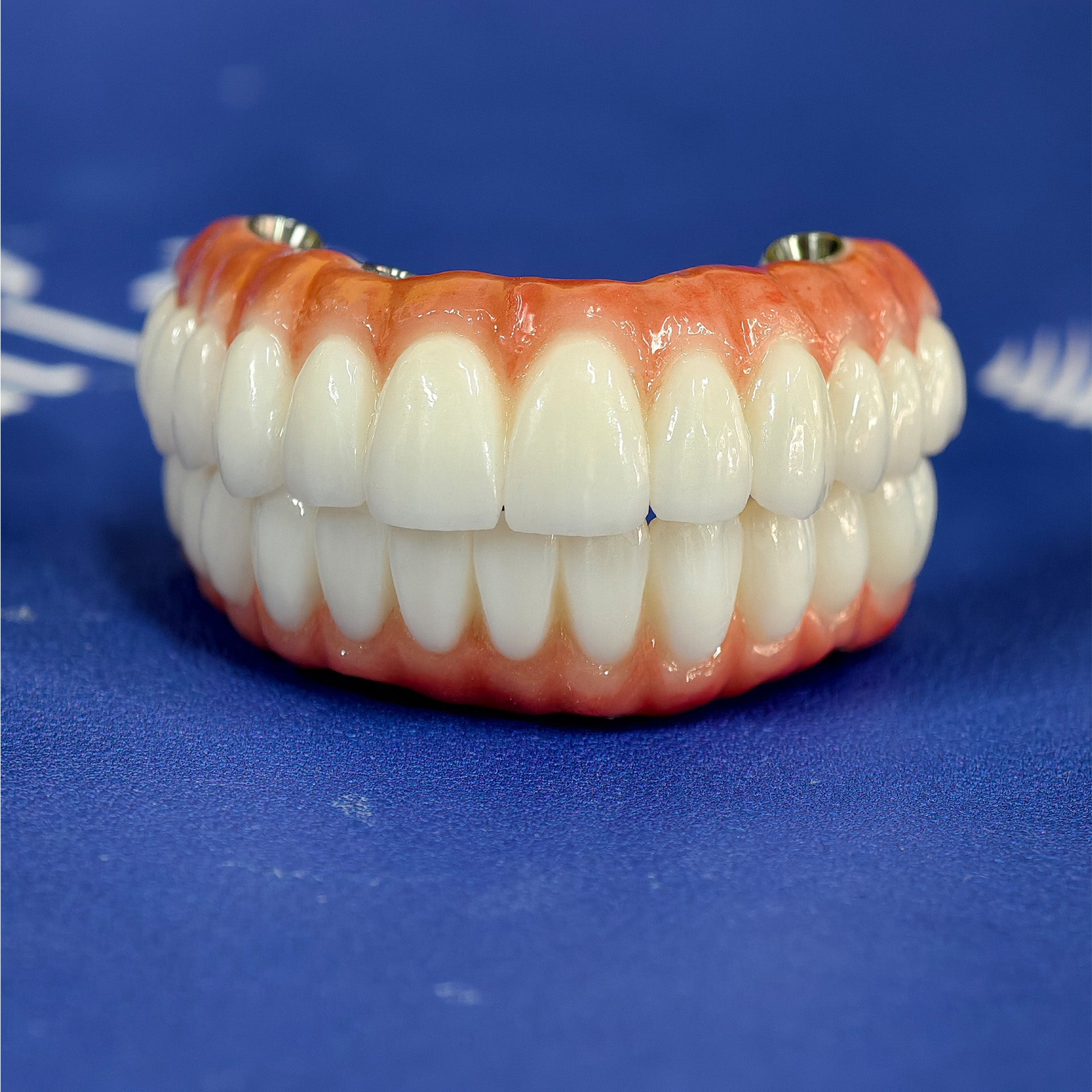 All On 4 Zirconia Bridge With Ti-Base Screw Retained Trying For Full Arch Restoration