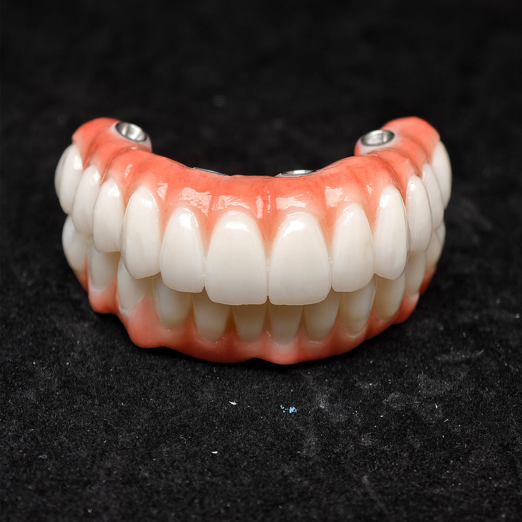 All On 4 Zirconia Bridge With Ti-Base Screw Retained Trying For Full Arch Restoration