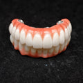 All On 4 Zirconia Bridge With Ti-Base Screw Retained Trying For Full Arch Restoration