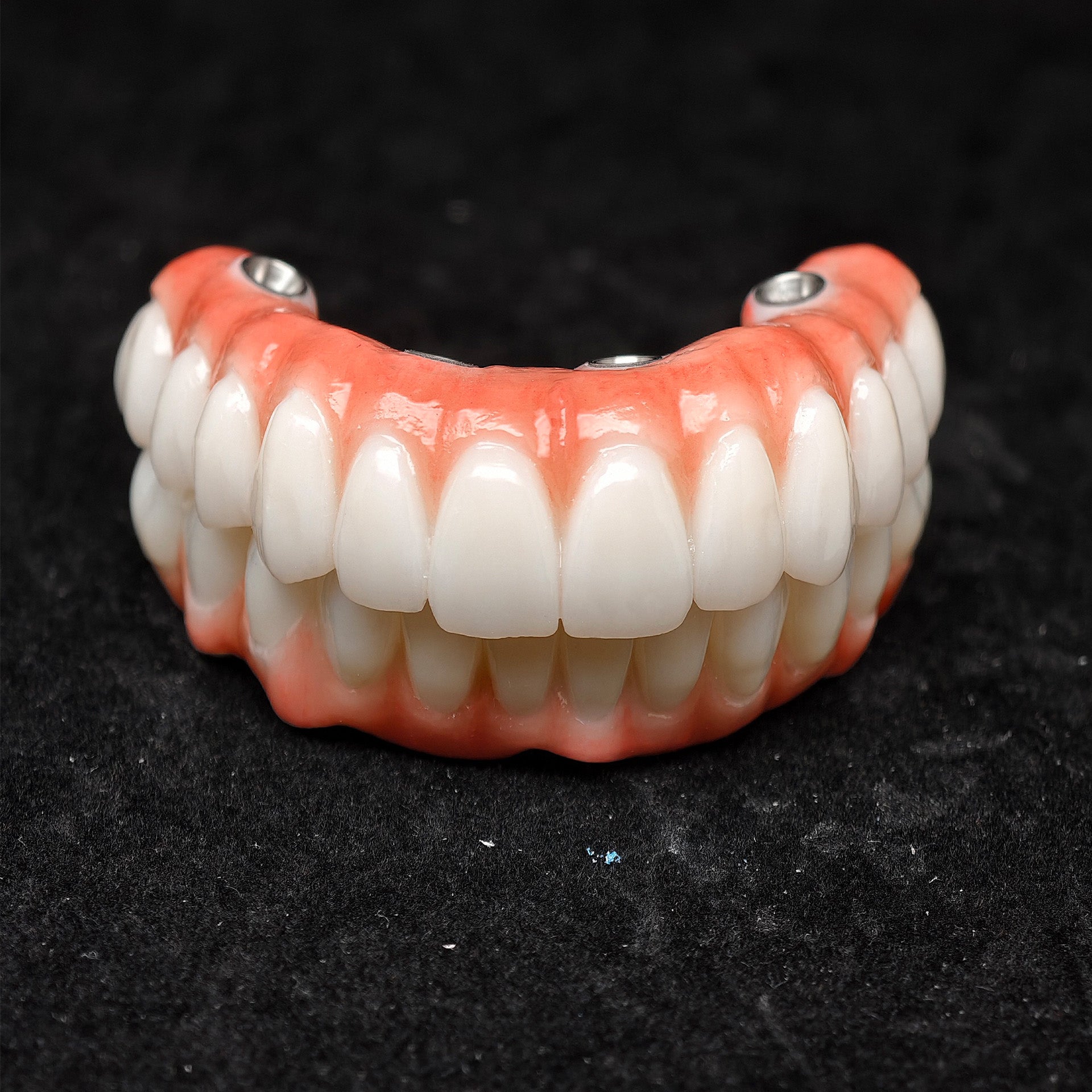 All On 4 Zirconia Bridge With Ti-Base Screw Retained Trying For Full Arch Restoration