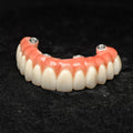 All On 4 Zirconia Bridge With Ti-Base Screw Retained Trying For Full Arch Restoration