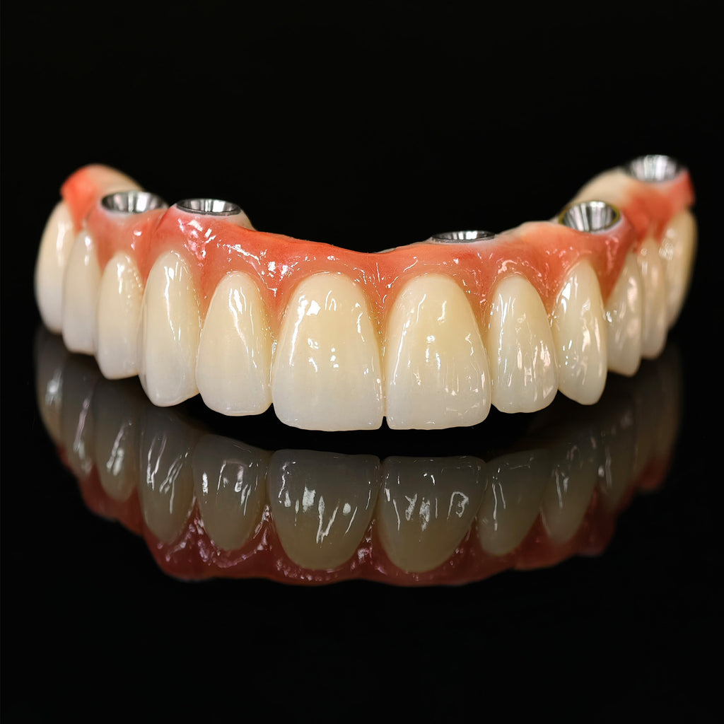 All On 5 Zirconia Bridge With Ti-Base Screw Retained Trying For Full Arch Restoration