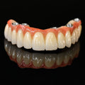 All On 5 Zirconia Bridge With Ti-Base Screw Retained Trying For Full Arch Restoration