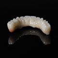 All On 5 Zirconia Bridge With Ti-Base Screw Retained Trying For Full Arch Restoration