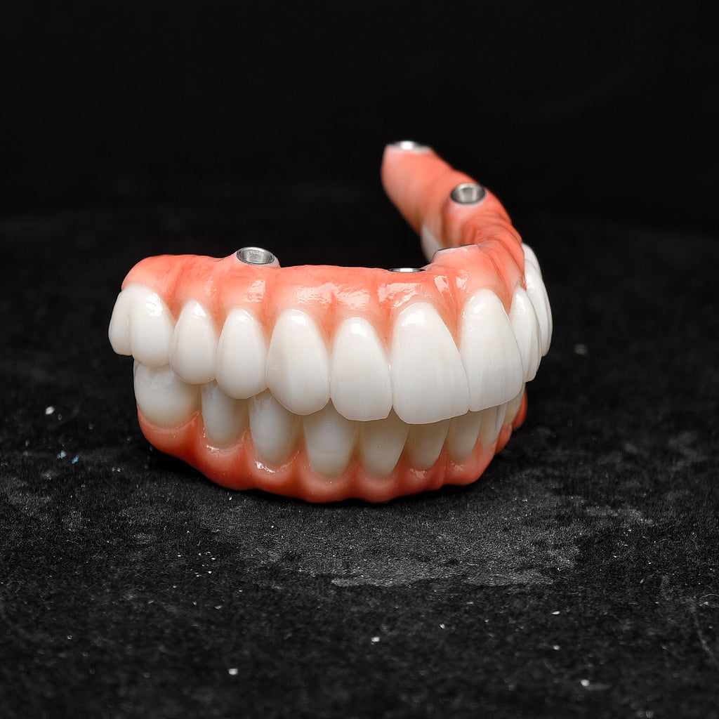 All On 5 Zirconia Bridge With Ti-Base Screw Retained Trying For Full Arch Restoration