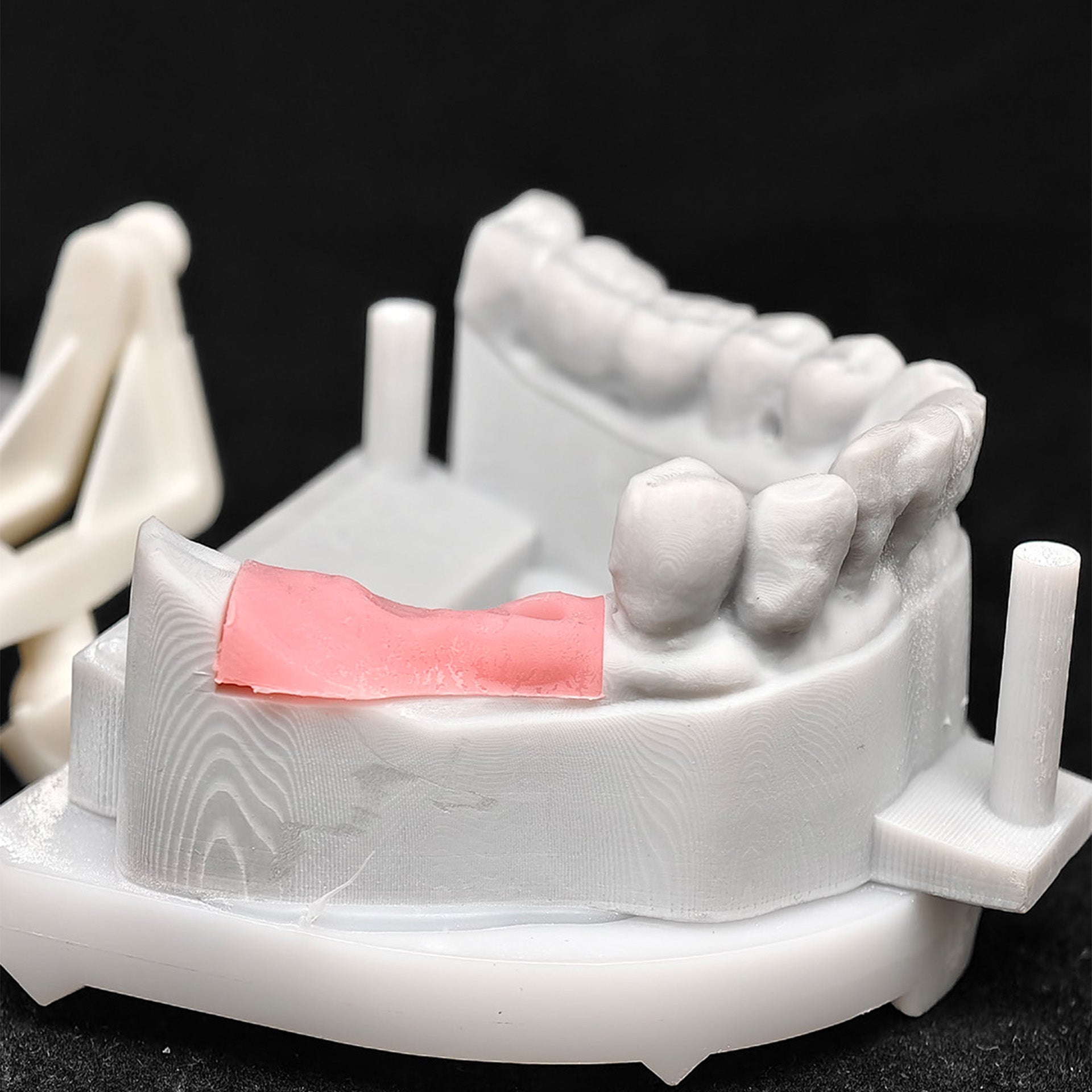 Custom Zirconia Implant Crowns