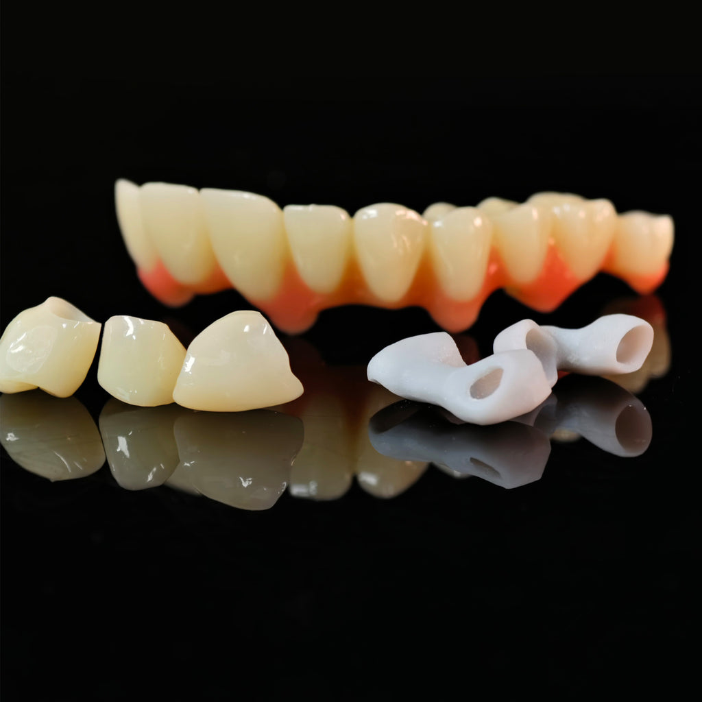 Custom Abutment And PMMA Bridge And Crown With Cement Retained