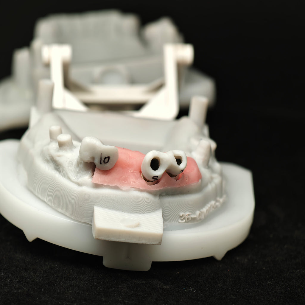 Custom Abutment With Zirconia Crown And Bridge