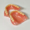 Full-Mouth Acrylic Denture