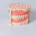 Full-Mouth Acrylic Denture