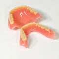 Full-Mouth Acrylic Denture