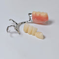 Full-Zirconia Crown And Bridge With Cement Retained And Co-Cr Frame Partial Denture