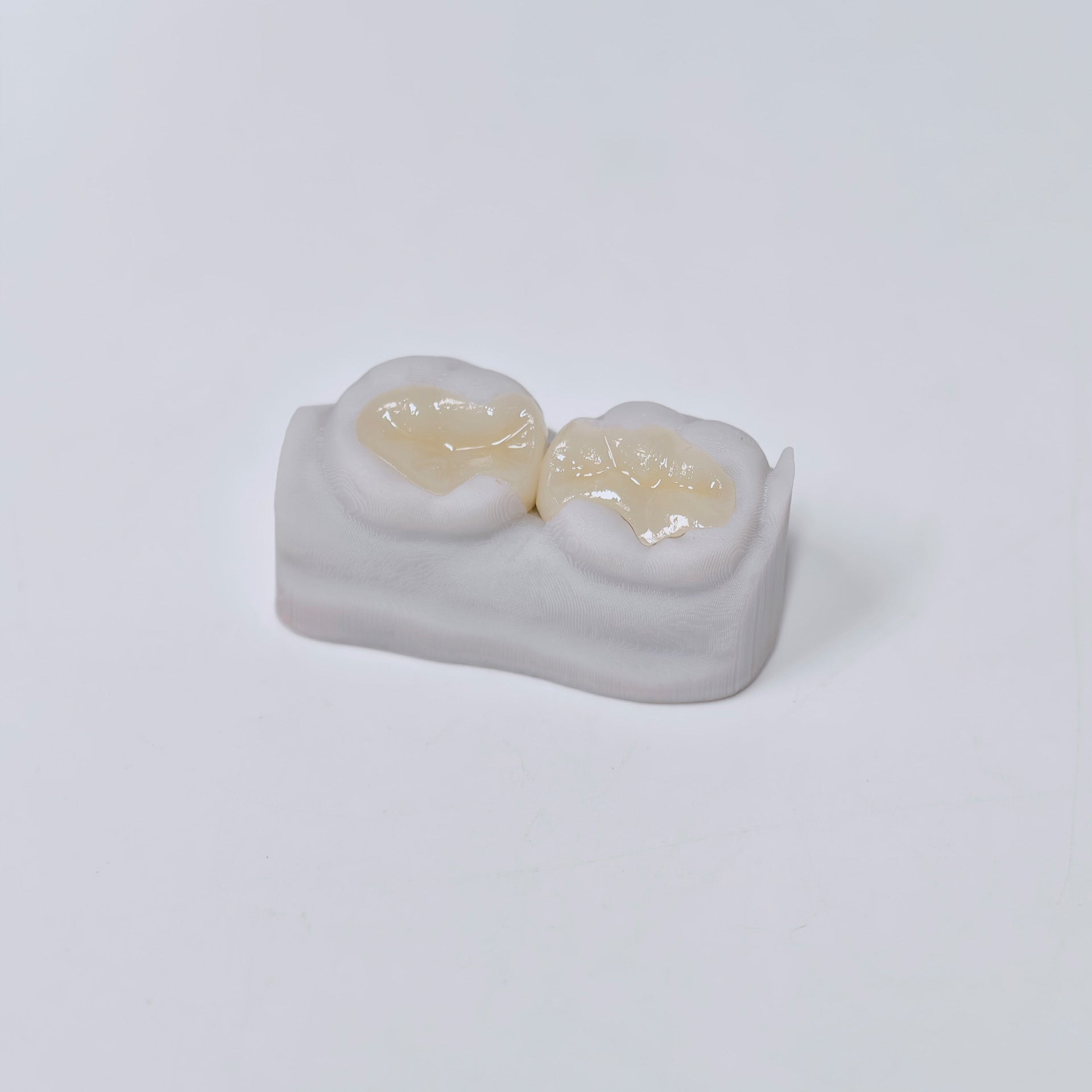 Full-Zirconia Laying With Cement-Retained
