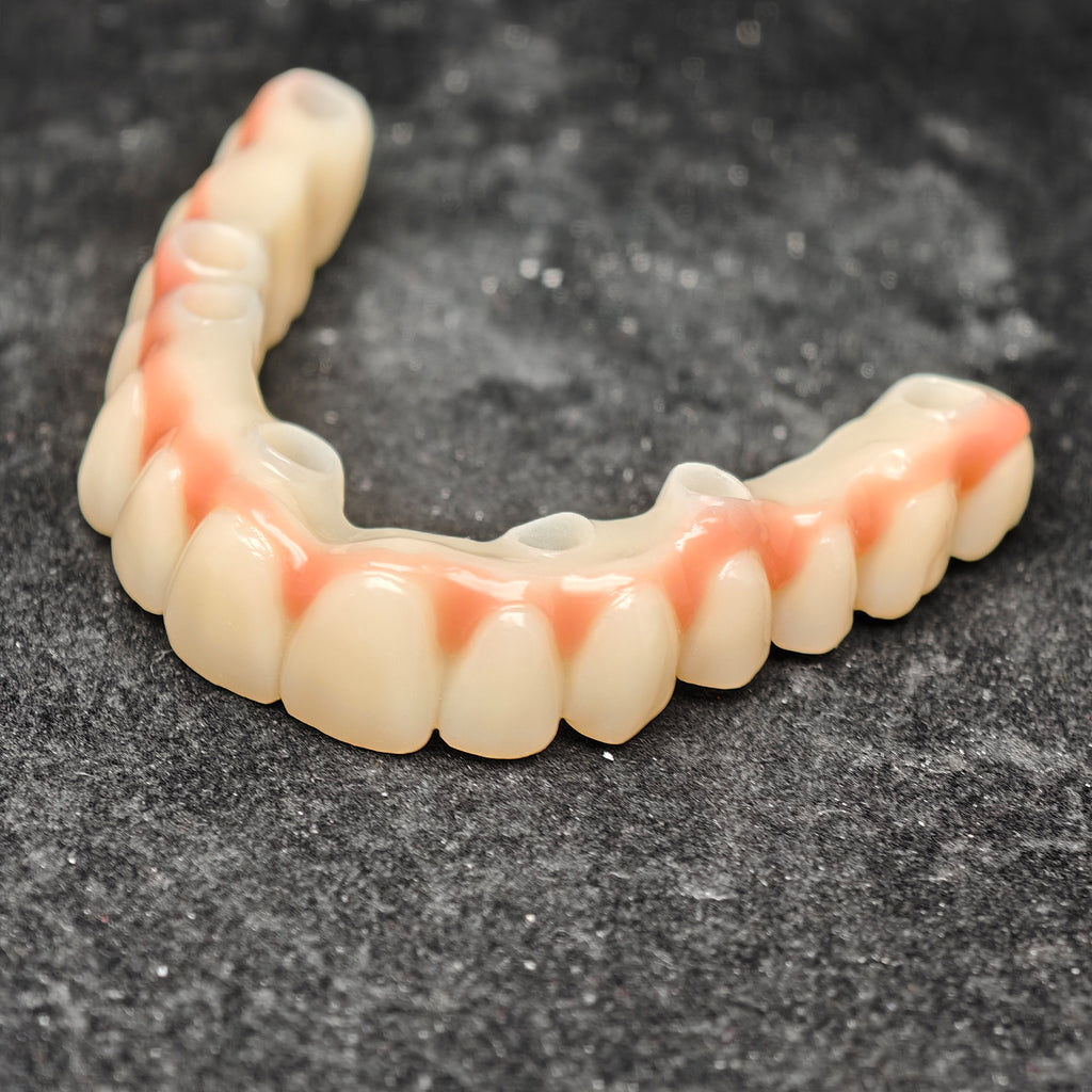Pmma Bridge And Zirconia Bridge With Cemented