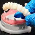 Pmma Bridge With Implant Seating Guide And Cemented