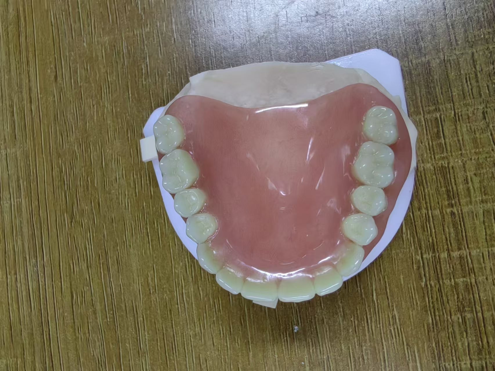 Acrylic Denture Resin Teeth Affordable Full Acrylic Denture