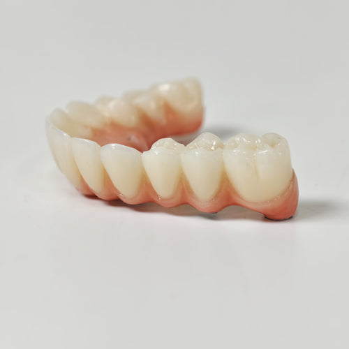 All On 5 Zirconia Bridge With Ti-Base Screw Retained