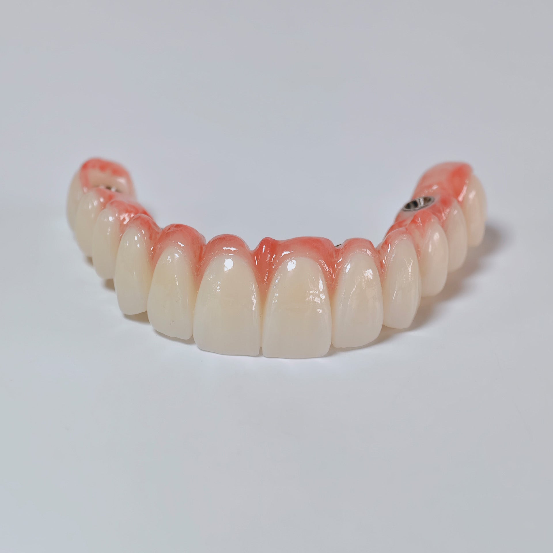 All On 6 Zirconia Bridge With Ti-Base Screw Retained