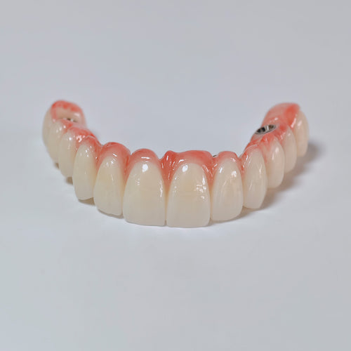 All On 6 Zirconia Bridge With Ti-Base Screw Retained