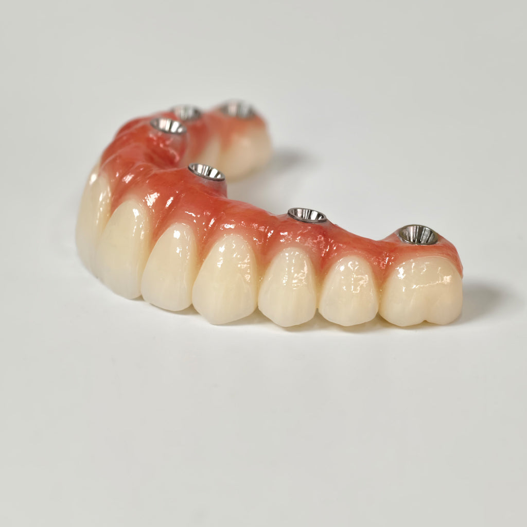 All On 6 Zirconia Bridge With Ti-Base Screw Retained