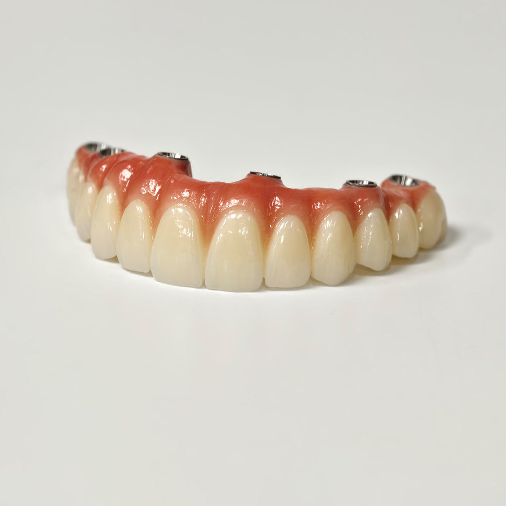 All On 6 Zirconia Bridge With Ti-Base Screw Retained