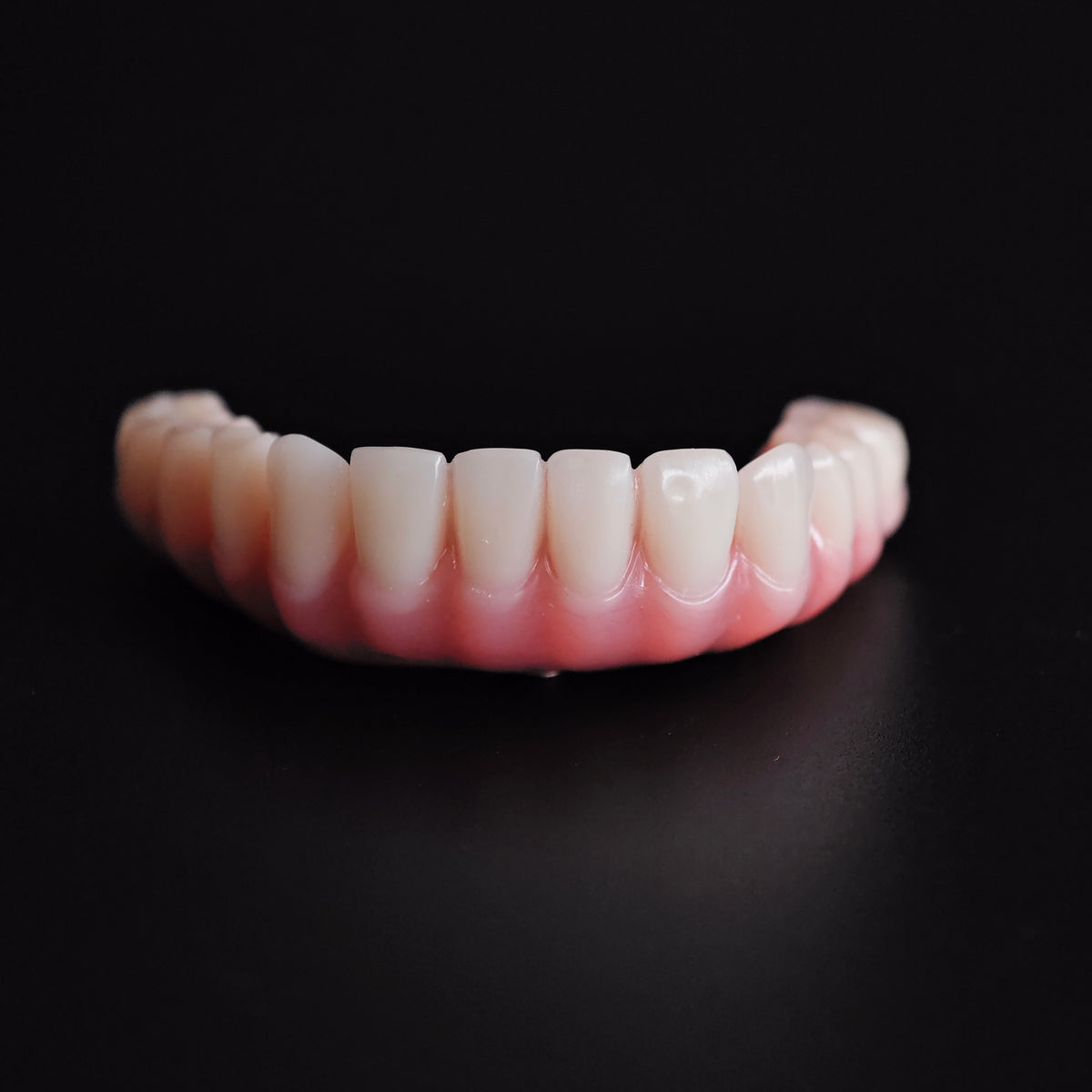 An Acrylic Denture With A Titanium Bar (Ti-Bar) Cost-Effective Full Arch Restoration Screw Retained