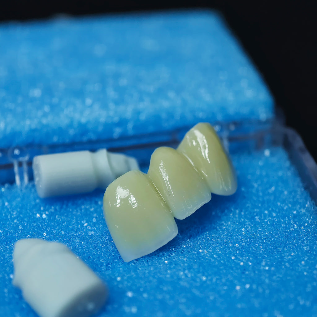 Beautiful Zirconia Bridge