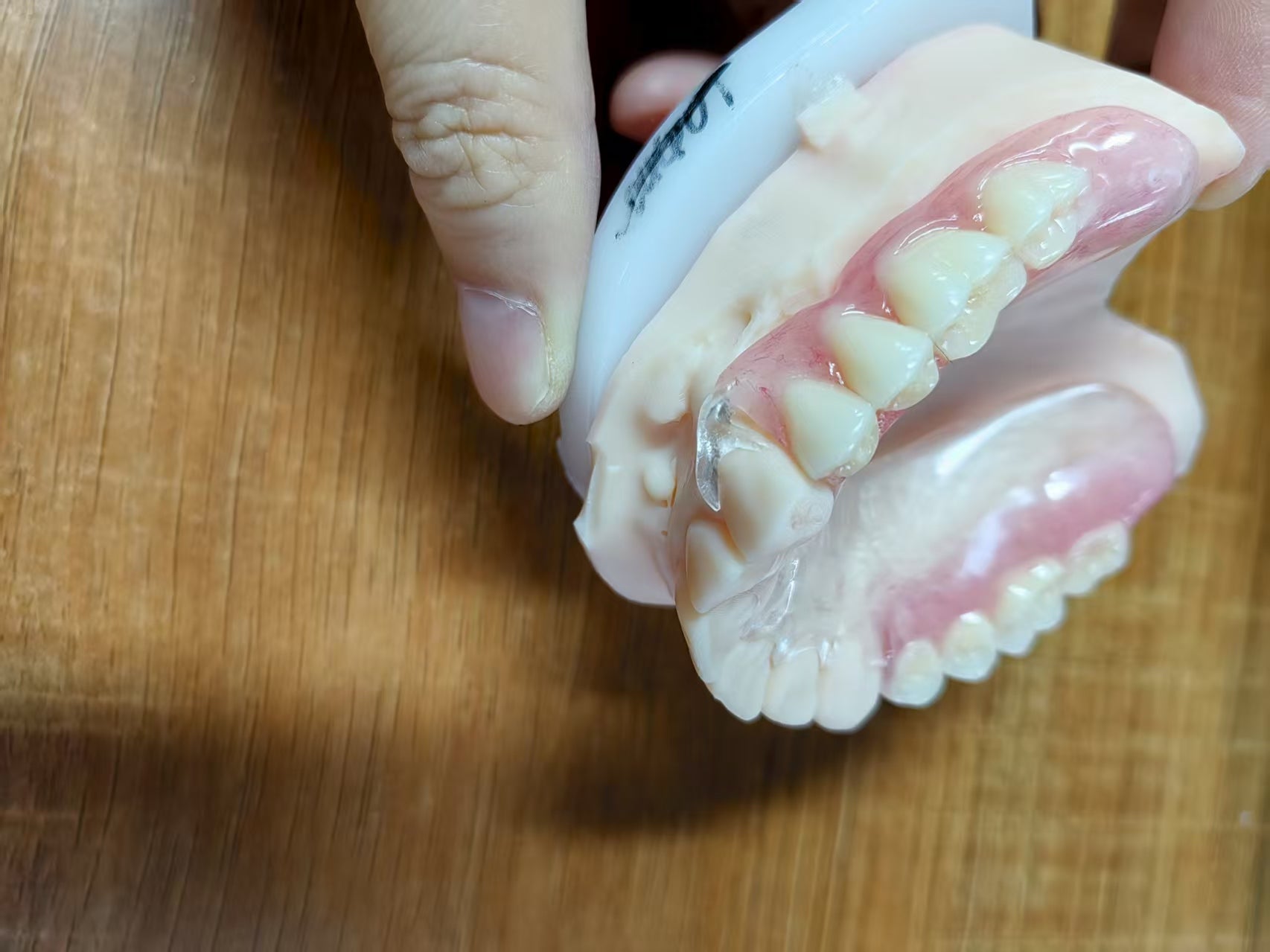 Clear Framework With Acrylic Denture Aesthetic Denture Dental Lab In China