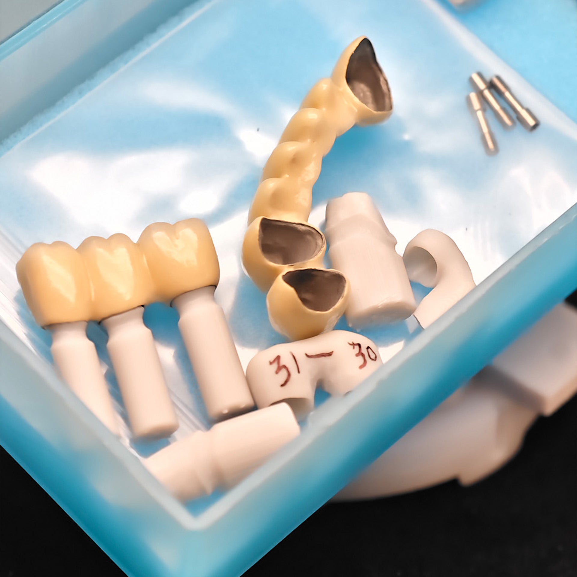 Co - Cr PFM Dental Bridge