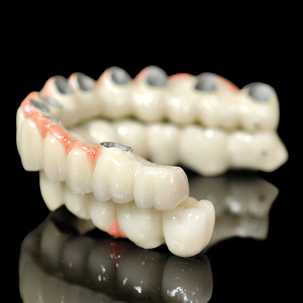 Co - Cr PFM Dental Bridge