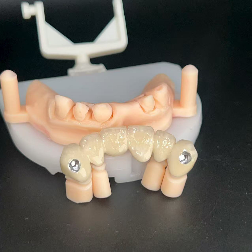 Co - Cr PFM Dental Bridge