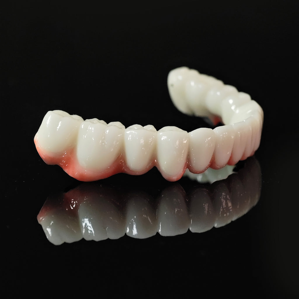 Co - Cr PFM Dental Bridge