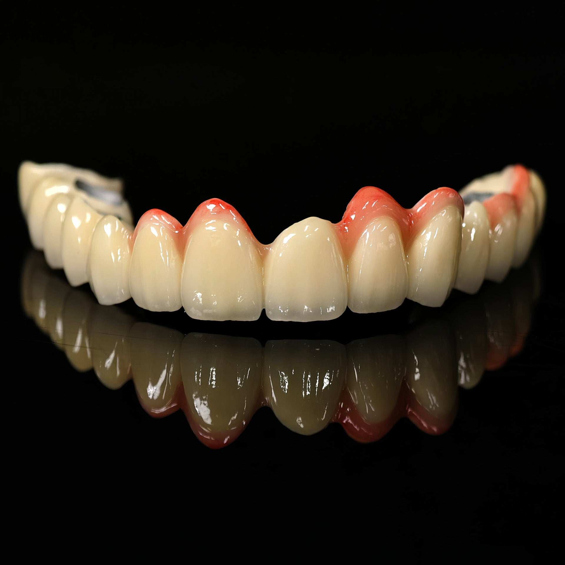 Co - Cr PFM Dental Bridge